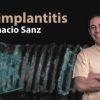 Peri-Implantitis - Ignacio Sanz