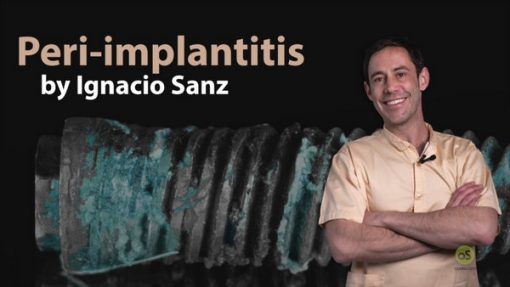 Peri-Implantitis - Ignacio Sanz