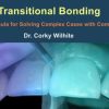 Transitional Bonding - The Formula for Solving Complex Cases with Components