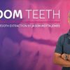 Wisdom Tooth Extraction-Jason Motta Jones